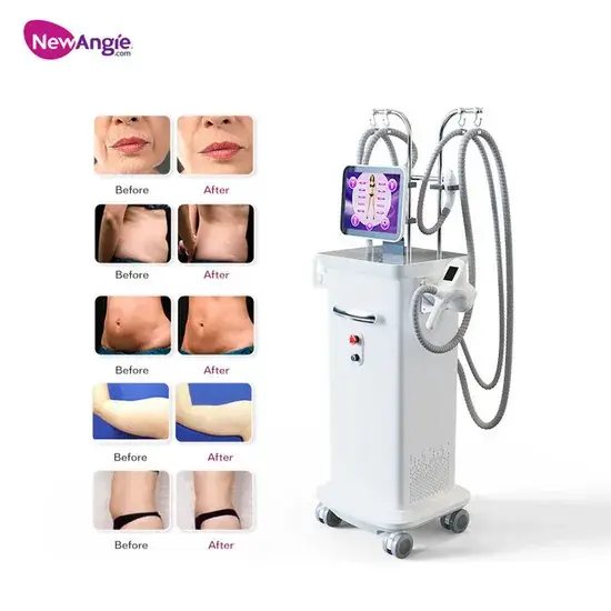 Thiết bị phổ biến giúp giảm cân và định hình cơ thể tại Bắc Kinh hình ảnh 1-description
