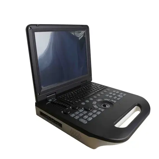 Sổ tay thú y 15-Inch với công nghệ siêu âm Doppler màu và siêu âm Pw 2D/3D hình ảnh 1-description