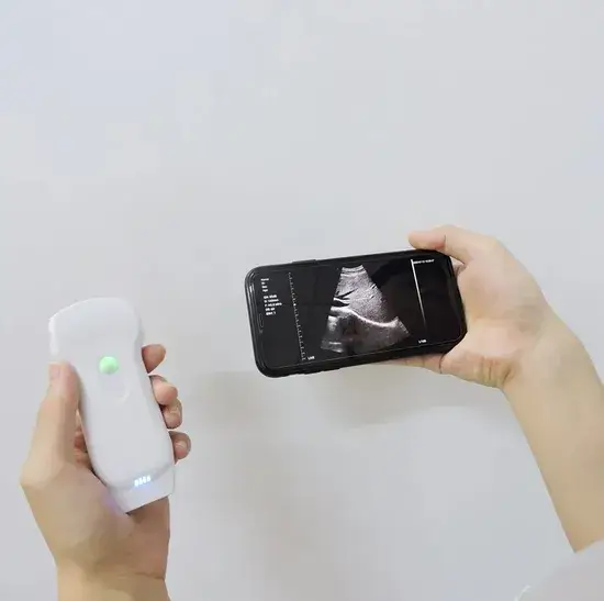 Siêu âm không dây 2 trong 1 - Hệ thống loại dò WiFi đầu dò đôi mini màu Doppler hình ảnh 1-description
